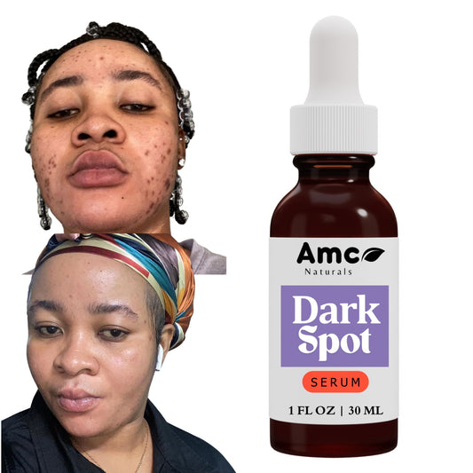 Dark Spot Corrector, Brightening and Clarifying Serum 1 FL OZ