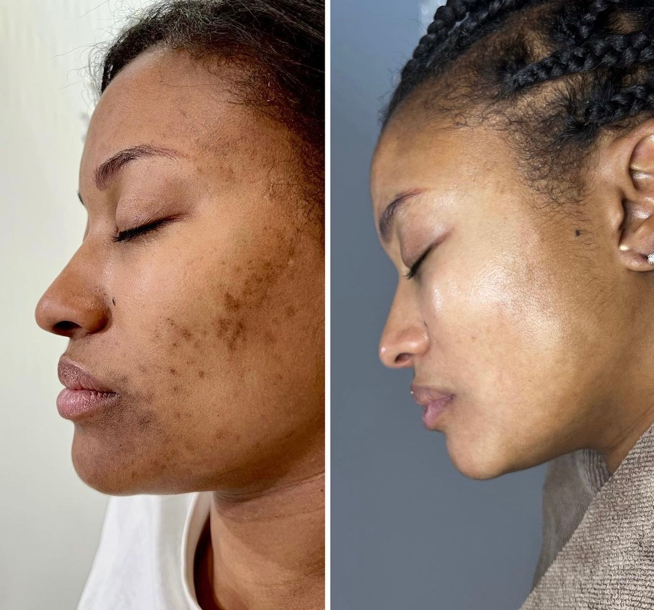 Turmeric Face Cream, Dark Spot Remover, Even, Glowing, Even Skin Tone 2FL OZ