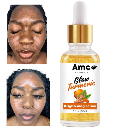 Turmeric Brightening Serum, Dark Spots Remover, Smooth & Even Skin Tone 1fl oz