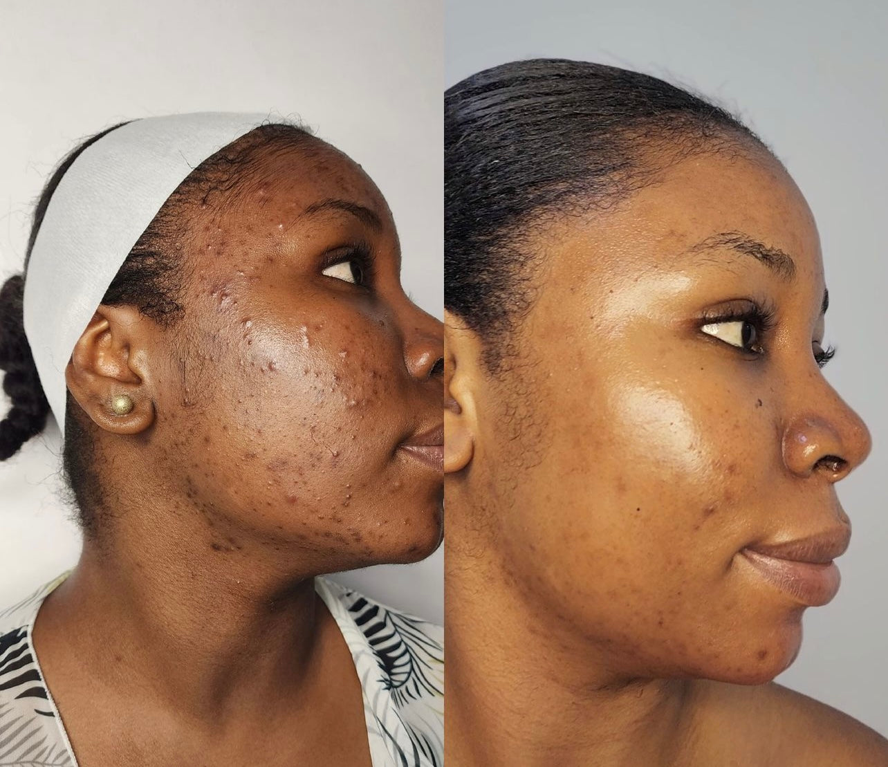 Turmeric Face Cream, Dark Spot Remover, Even, Glowing, Even Skin Tone 2FL OZ
