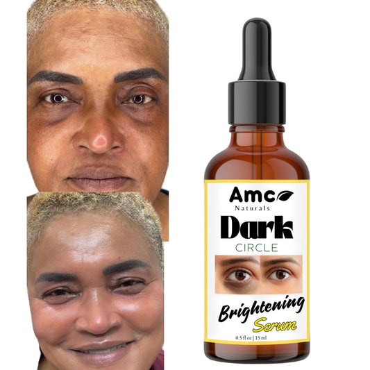 Dark Circle Serum, Under-eye Brightening Serum, Dark Circle Corrector 0.5fl oz